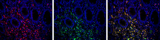 Tsa Staining Kit mIHC TSA EnkiLife Multiple Staining 25% Off | Microtech